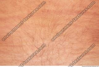 Photo Textures of Human Skin